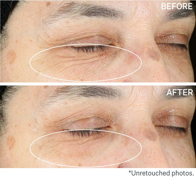 HYPERLIFT™ Natychmiastowa kuracja napinająca i liftingująca pod oczy