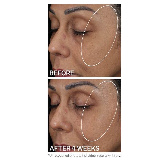 StriVectin Serum nawilżające z kwasem hialuronowym