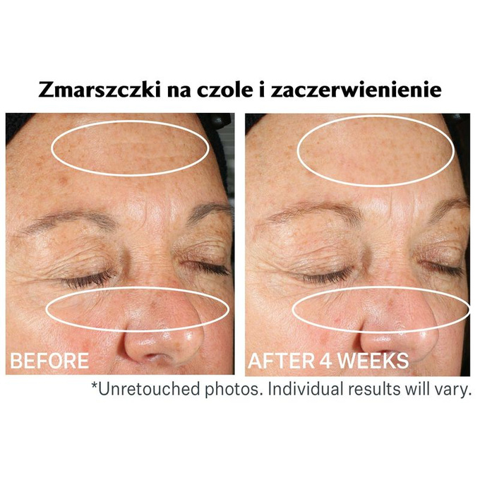Wrinkle Recode™ Silnie nawilżający krem barierowy
