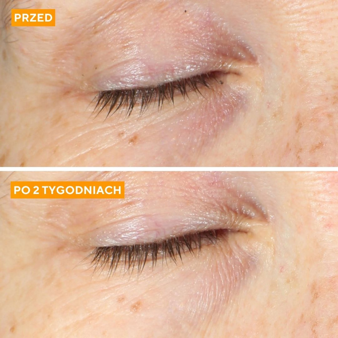 Krem pod oczy Vita-C Eyes Dark Circle Corrector