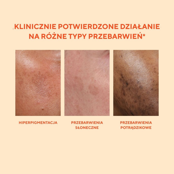 Murad Serum do twarzy Rapid Dark Spot Correcting Serum