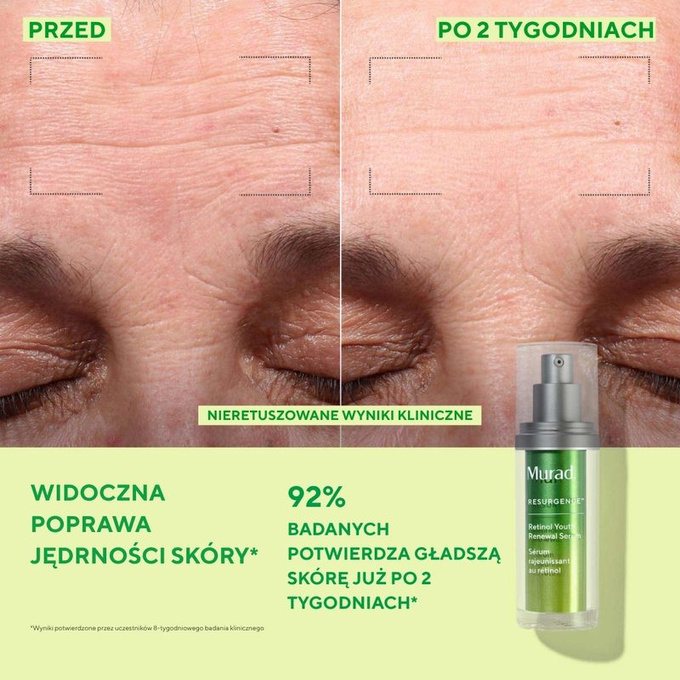 Murad Serum do twarzy Retinol Youth Renewal Serum, 30 ml