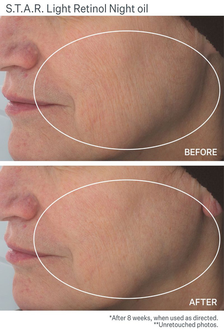 StriVectin S.t.a.r.light™ Olejek z retinolem na noc