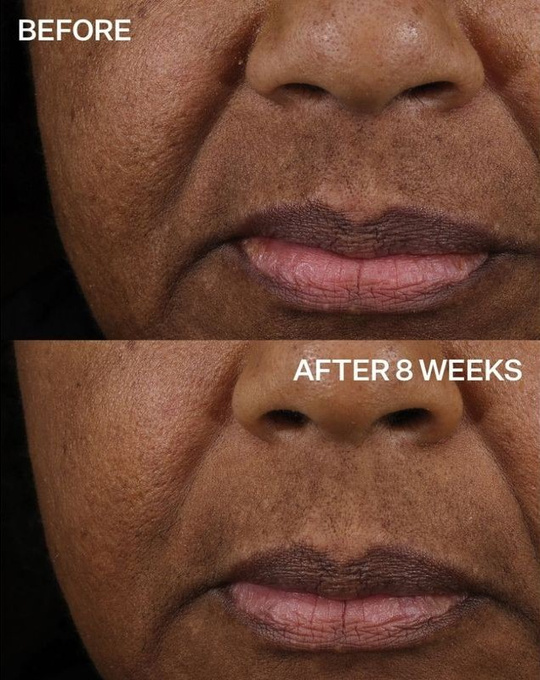 StriVectin TL Peptight Lift Serum Liftingujące, 30 ml