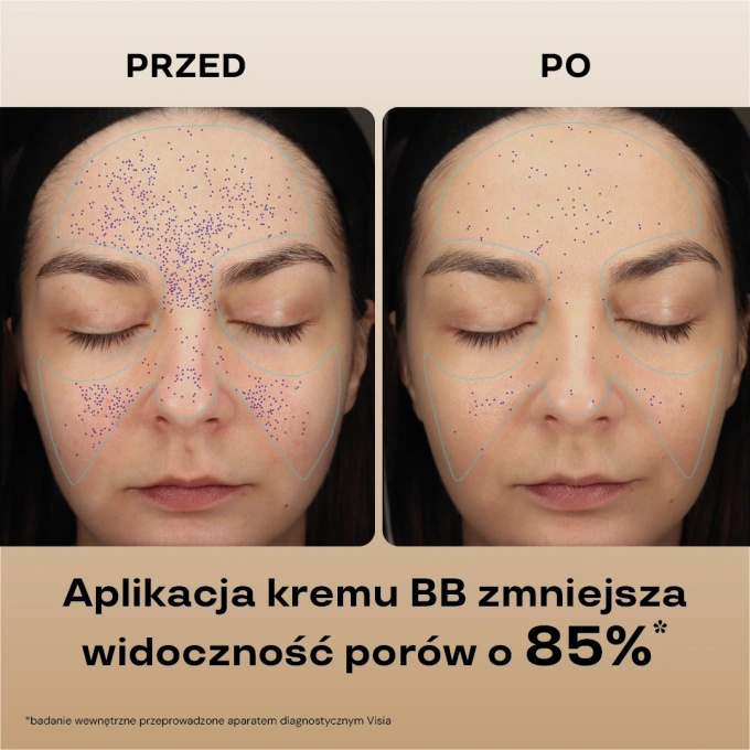 BasicLab Nawilżający krem BB SPF 15 – 310 Honey, 33 ml