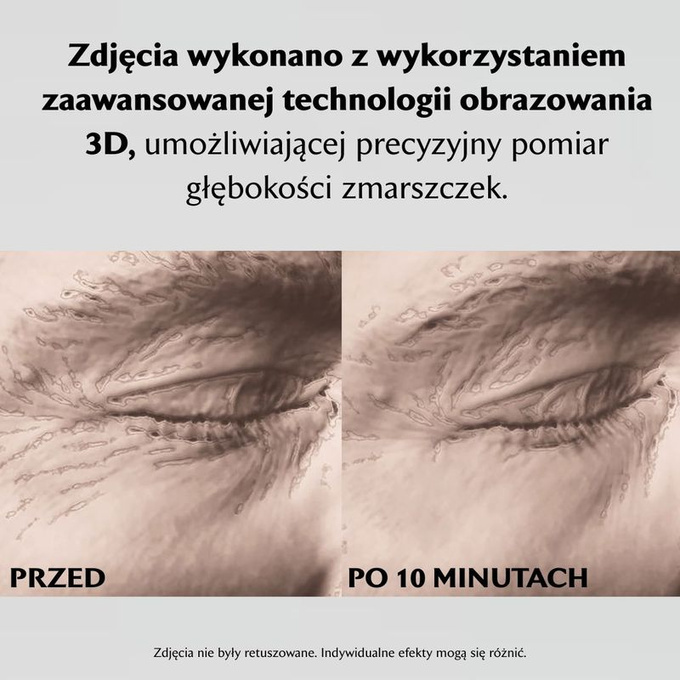 StriVectin Peptide Plump™ Kolagenowe płatki pod oczy, 6 par