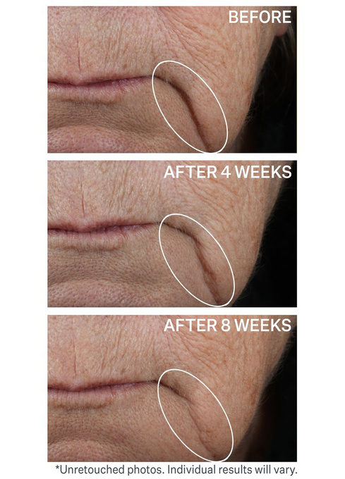 StriVectin Contour Restore napinająco-rzeźbiący krem to twarzy 50 ml