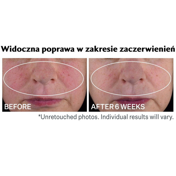 StriVectin Serum na noc z retinolem 30 ml