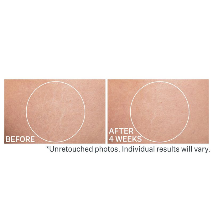 StriVectin SD Advanced Plus Krem na zmarszczki i rozstępy 60 ml