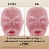 BasicLab Nawilżający krem BB SPF 15 – 310 Honey, 33 ml