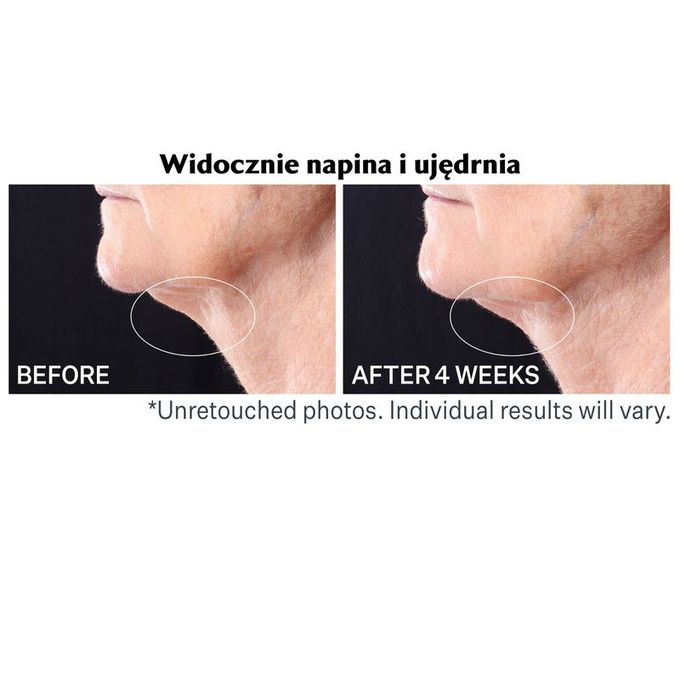 StriVectin Serum napinające z rollerem do szyi