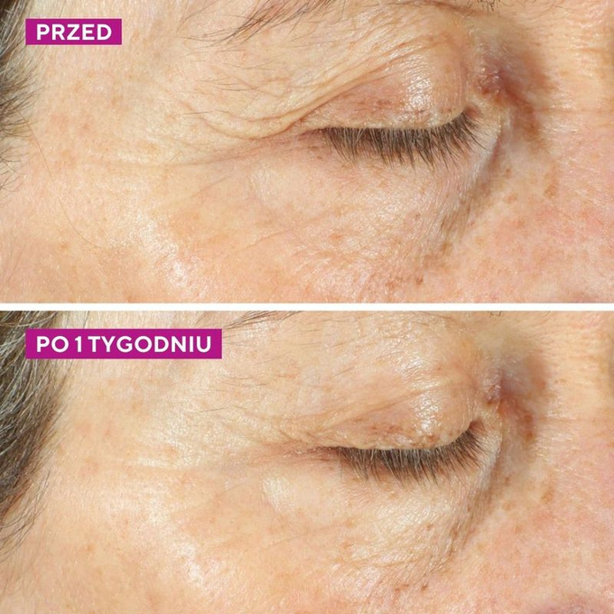 Murad Kojący krem nawilżający do twarzy i oczu Intense Recovery Cream